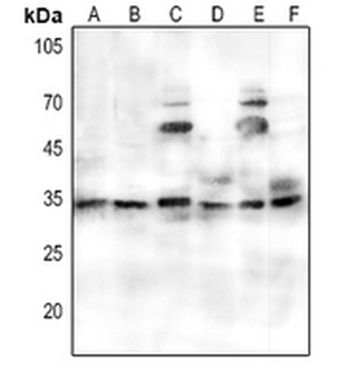 Anti-PORIN Antibody