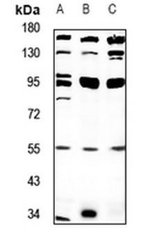 Anti-PPP4R2 Antibody