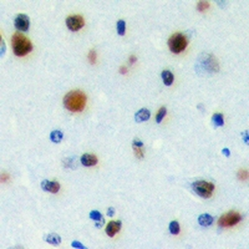 Anti-PWWP2B Antibody