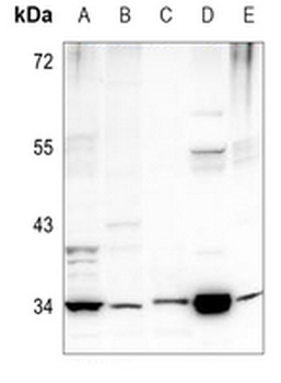 Anti-PEX2 Antibody