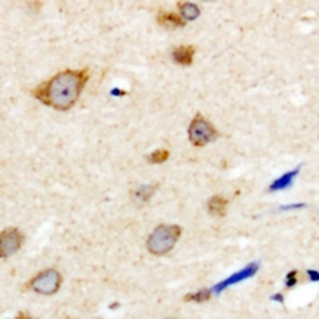 Anti-NBPF5 Antibody