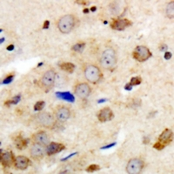 Anti-GABRG1 Antibody