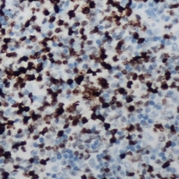 Anti-CCNB1IP1 Antibody