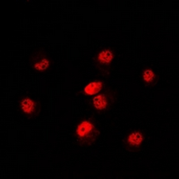 Anti-POLR3E Antibody