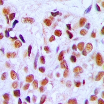 Anti-RRP8 Antibody