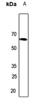 Anti-Arylsulfatase I Antibody