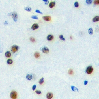 Anti-ZNF785 Antibody