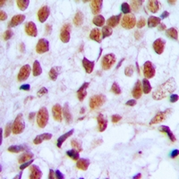 Anti-FOXK1 Antibody