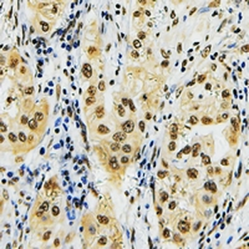 Anti-ID4 Antibody