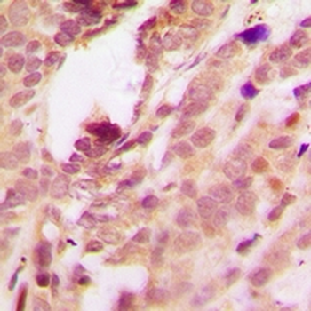 Anti-p38 (pT180/Y182) Antibody