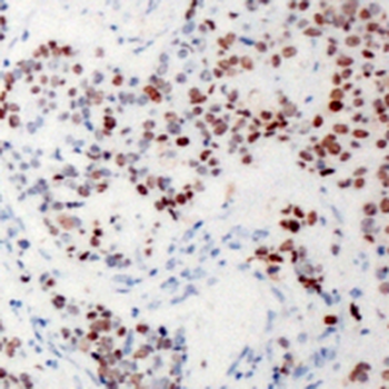 Anti-XRN2 Antibody