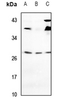 Anti-VTI1A Antibody