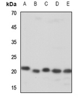Anti-ZNF695 Antibody