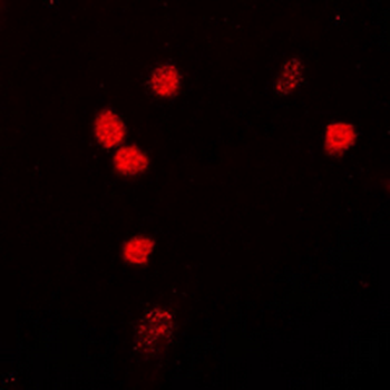 Anti-NIPA Antibody