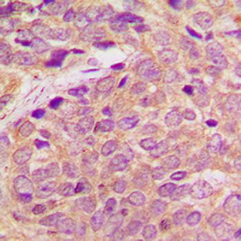 Anti-RB3 Antibody