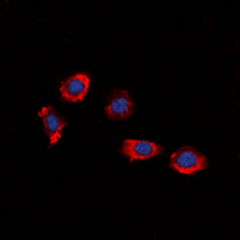Anti-P2Y8 Antibody