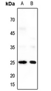 Anti-Neuromedin U Antibody