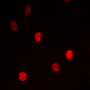 Anti-TRAP100 Antibody