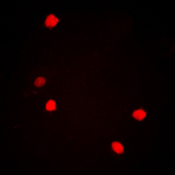 Anti-c-Jun (pS73/100) Antibody
