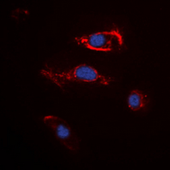 Anti-FGF22 Antibody