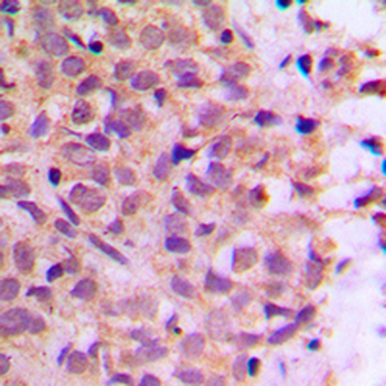 Anti-Zeta COP Antibody
