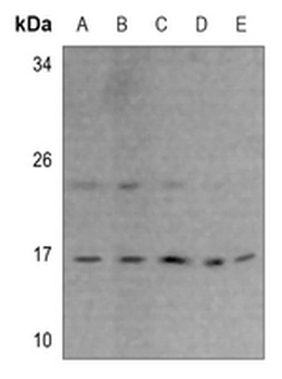 Anti-RPS23 Antibody