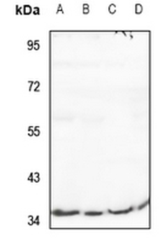Anti-RIMKLB Antibody