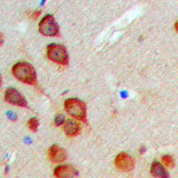 Anti-MEKKK6 Antibody
