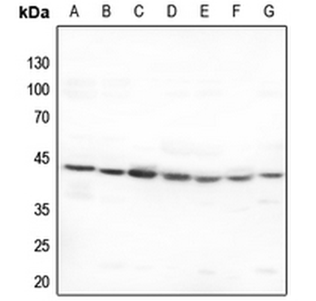 Anti-5-HT1F Antibody