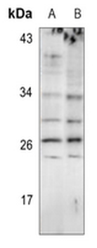 Anti-EIF4E3 Antibody