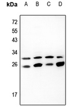Anti-EIF3K Antibody