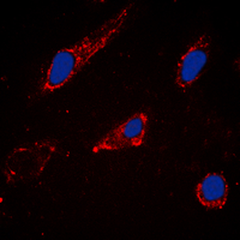 Anti-Cytochrome P450 2C19 Antibody