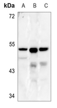 Anti-CLN5 Antibody
