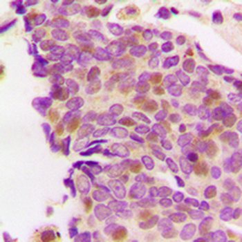 Anti-PS1D Antibody
