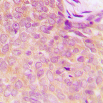 Anti-UBA5 Antibody