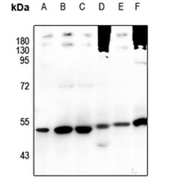 Anti-TRIM38 Antibody