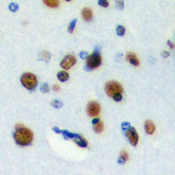 Anti-RFWD3 Antibody