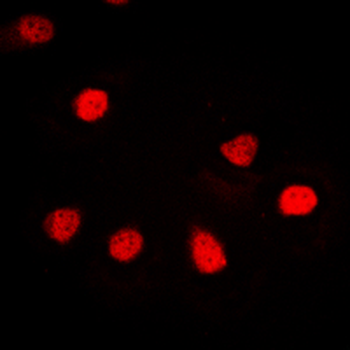 Anti-hnRNP G Antibody
