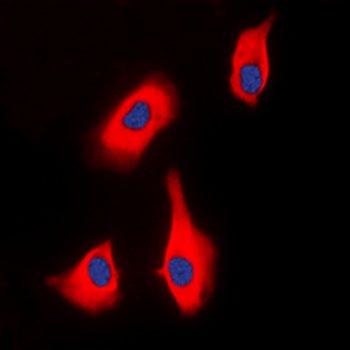 Anti-PTHR1 Antibody