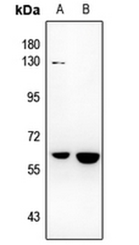 Anti-NR4A3 Antibody