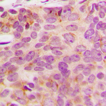 Anti-NDUFA3 Antibody