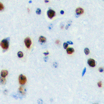 Anti-LYL1 Antibody