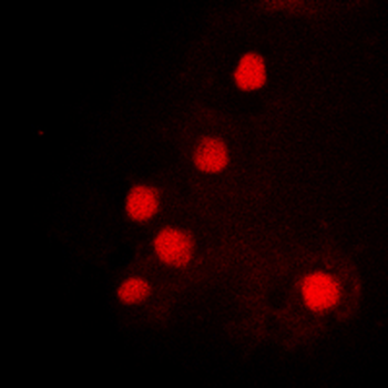 Anti-HOXC6 Antibody
