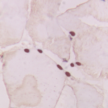 Anti-GNAT1 Antibody
