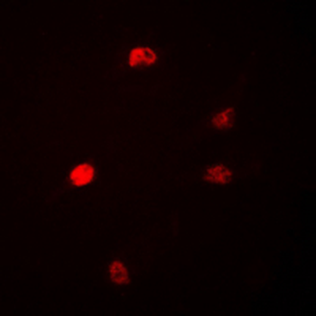 Anti-DUSP22 Antibody