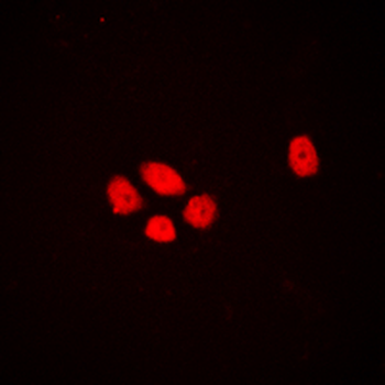 Anti-DLX3 Antibody