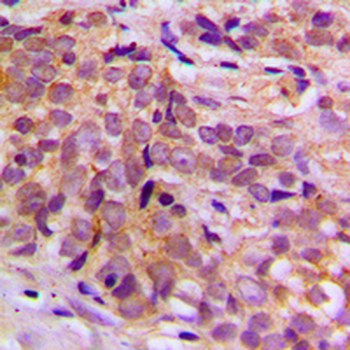 Anti-CEP170 Antibody