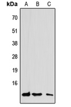 Anti-CCL7 Antibody