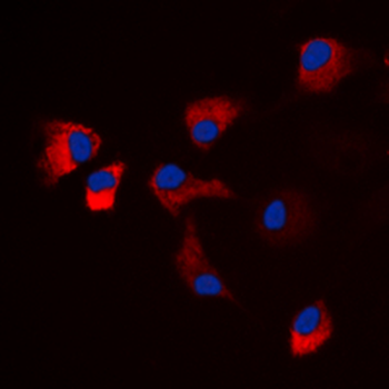 Anti-CaMK2 alpha/delta (pT286) Antibody