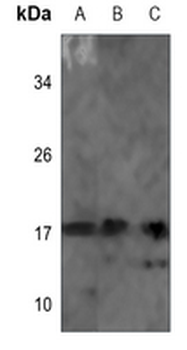 Anti-NDUFB7 Antibody